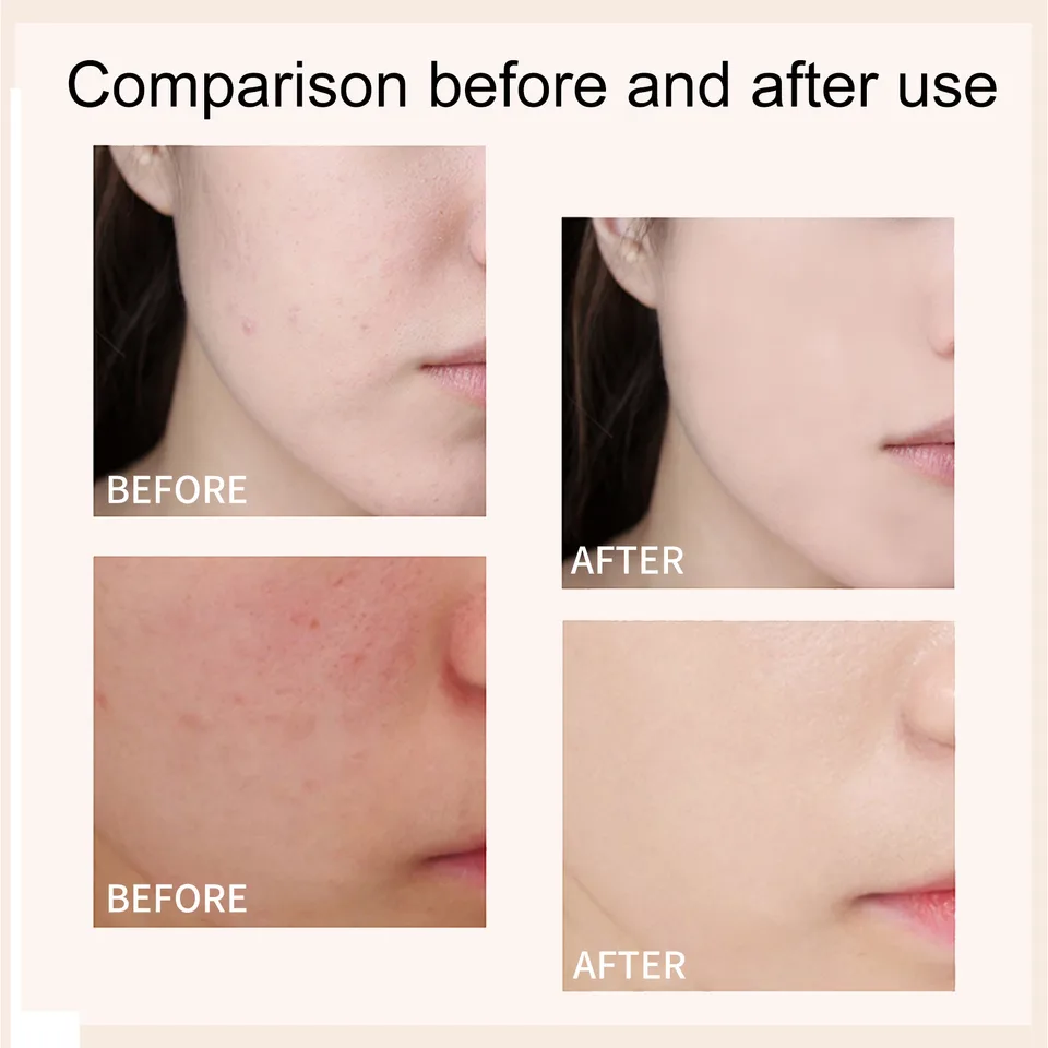 EELHOE Pre-Makeup Primer, A Moisturizing, Concealing, Skin-brightening, And Smooth Pre-makeup Foundation view 4
