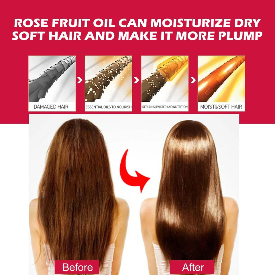EELHOE Rosehip Facial Oil For Facial And Body Hydration, Nourishing Skin Care, Smooth Hair Care, And Massage Oil view 4