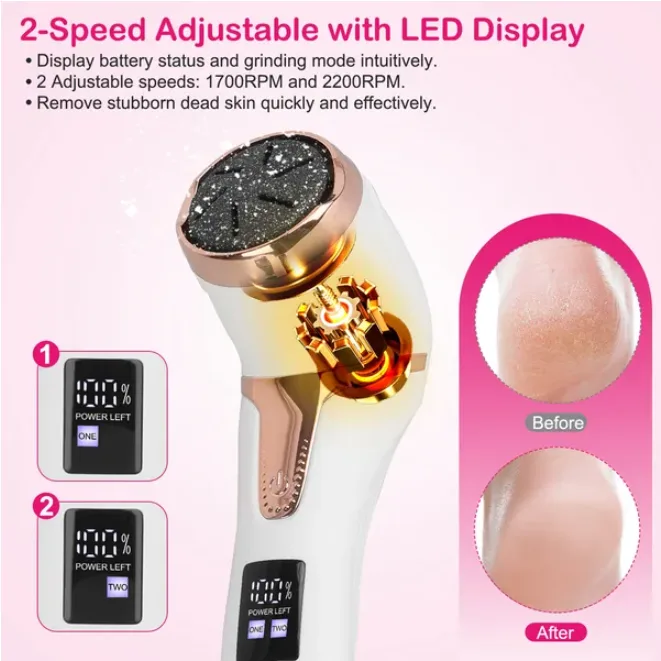 17 Pcs Electric Foot Callus Remover view 3
