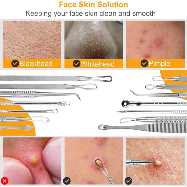 7 Pcs Blackhead Remover Kit Stainless Steel Pimple Comedone Acne Extractor Needle Tools view 4