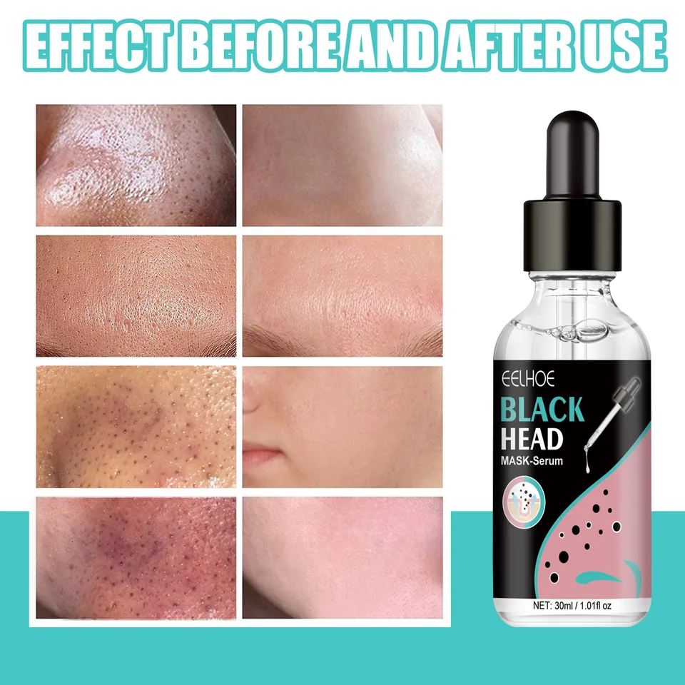 EELHOE Blackhead Nose Mask Moisturizes And Smoothes The Skin, Removes Blackheads From Acne And Deeply Cleans Pores And Dirt view 6