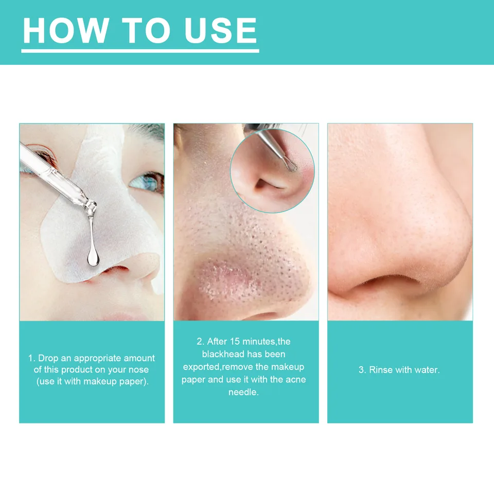 EELHOE Blackhead Nose Mask Moisturizes And Smoothes The Skin, Removes Blackheads From Acne And Deeply Cleans Pores And Dirt view 2
