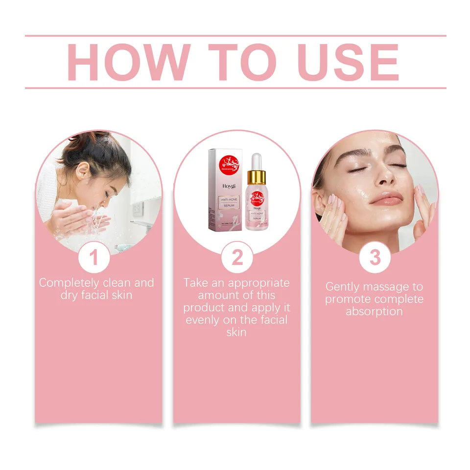 Hoygi Nicotinamide Anti-Acne Serum Mild Anti-Acne Serum Improve Acne Moisturizing Repair Serum view 2