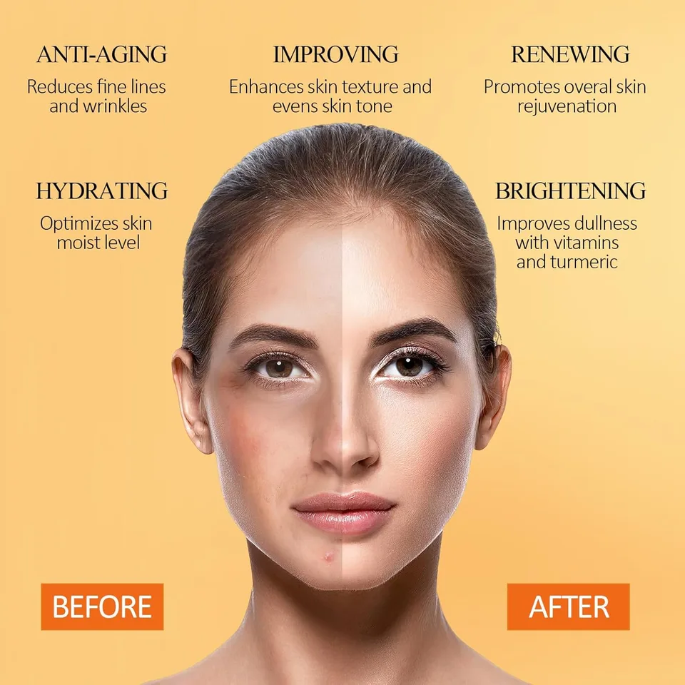 Turmeric Vitamin C Clay Mask With Kaolin Clay For Dull & Blemish-Prone Skin, Deep Cleansing Facial Mask For Controlling Oil And Refining view 3