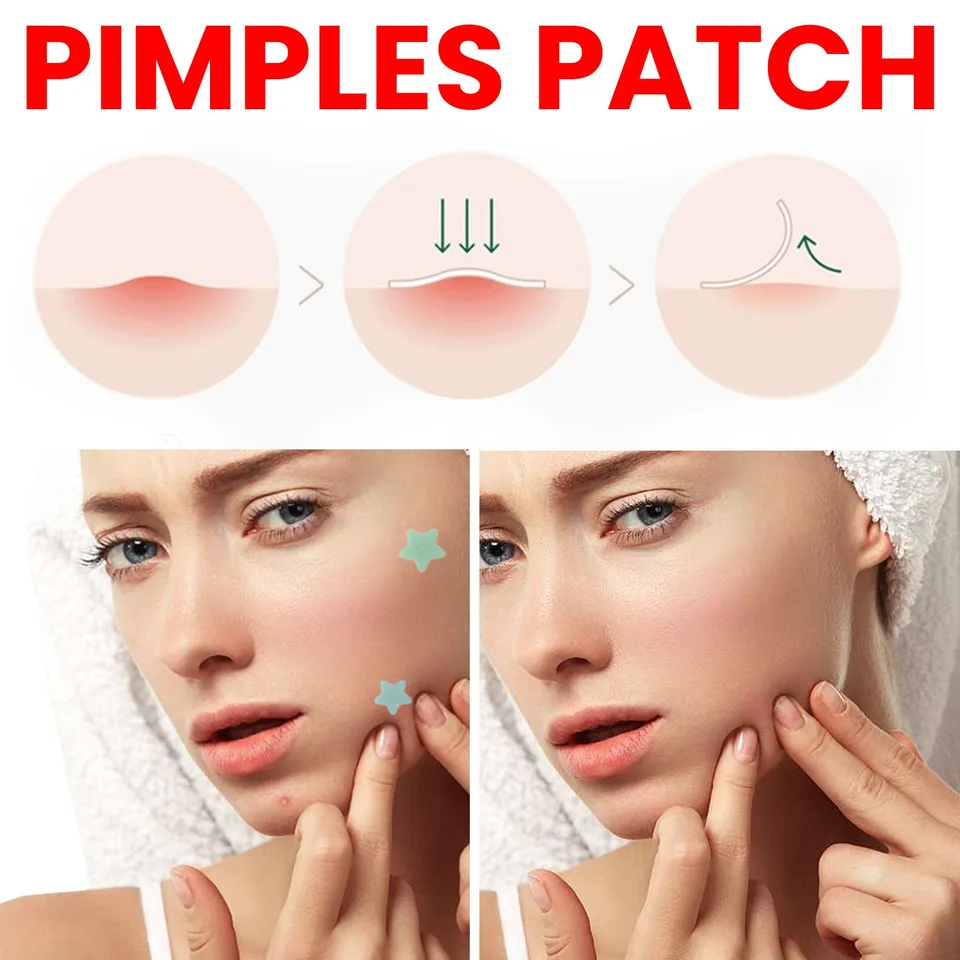 Repair Acne Patch,200patches view 5