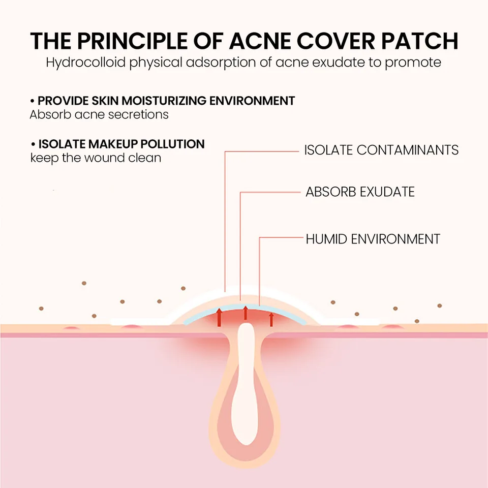 Repair Acne Patch,200patches view 2